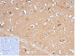 AKR1B1 Rabbit anti-Human, Clone: AKR1B1/7009R, Novus Biologicals 100 &mu;g;